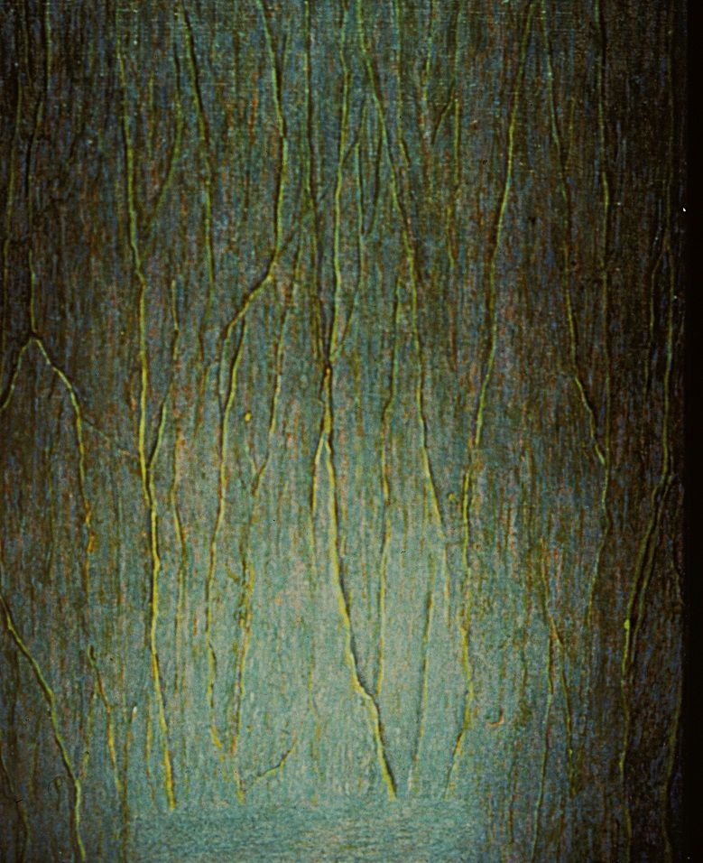 Probleem bij het laden van de afbeelding